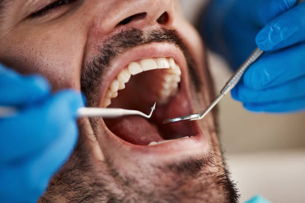 Best Pediatric Emergency Dentist in Shoreline, WA